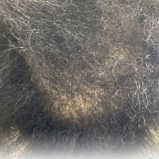 Is your hair breaking, thinning, or refusing to grow?

It may not be your shampoo, it could be your 