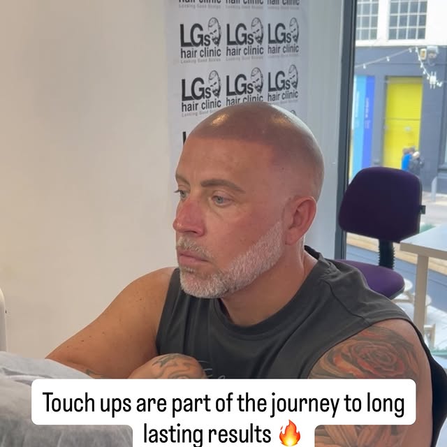 Touch-ups are part of achieving long-lasting SMP results 🔥

Over time a refresh session helps maint