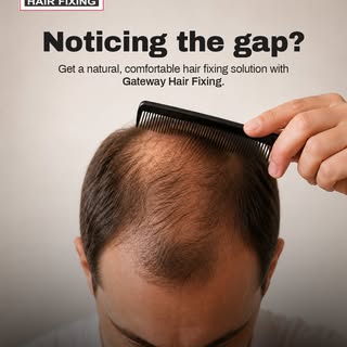 Hair loss can affect your confidence, but it doesn't have to define you. Gateway Hair Fixing offers 