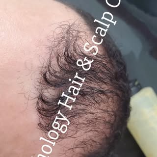 Recupera tu cabello y la salud de tu cuero cabelludo con nosotros de una manera natural 💆🏻‍♀️🌿💆�