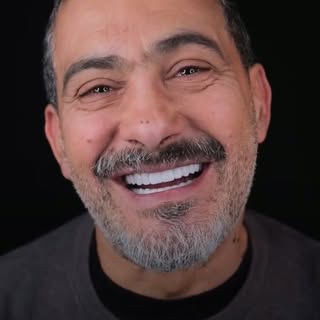 From hiding his smile…
to lighting up the room.✨

Dental implants don’t just restore teeth —
they re
