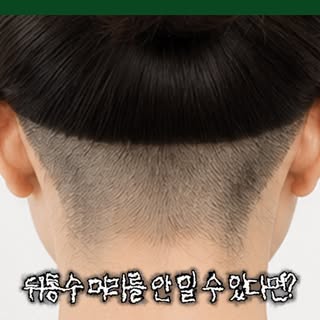 누썹이식 삭발하지않고 가능할까요..?🤔
#모발이식 #강남모발이식 #눈썹이식 #탈모