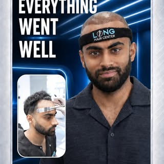 Coming from the US to Turkey for a hair transplant is easier than ever. With a little research, you 