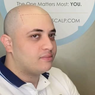 👉 Hair-loss Solution For Men and Women🔥🤘
 
🤘Organic Pigment For The Natural Look!

👌Services Pr