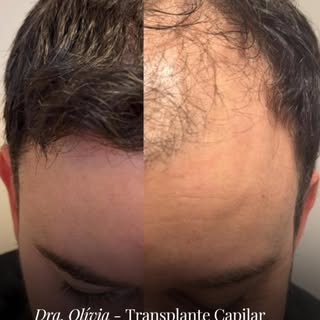 Recuperar o cabelo também pode significar recuperar confiança, autoestima e segurança com a própria 