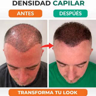 ✨ De inseguridad a confianza en segundos ✨

Mira este antes y después… 👀
Así es como una micropigme