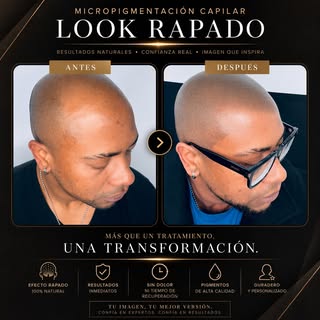 ✨ Recupera tu imagen con un look impecable ✨

¿Cansado de la pérdida de cabello o entradas?
La micro