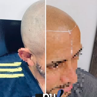 La micropigmentación capilar look rapado crea un acabado natural, moderno y masculino desde la prime