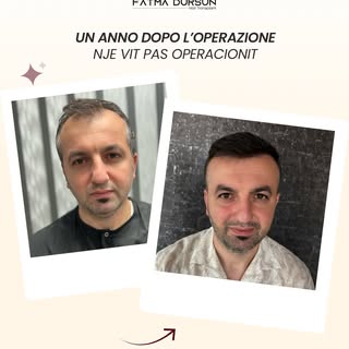 Un’attaccatura naturale, una maggiore densità e una ritrovata sicurezza di sé davanti allo specchio.