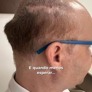 Ele chegou até mim com um grande desafio: a área doadora não estava preparada para um transplante ca