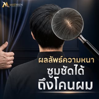 ซูมชัด...มั่นใจได้ถึงโคนผม! 🔍✨ 
เปลี่ยนความกังวล ให้เป็นความมั่นใจที่ซูมดูได้ใกล้ๆ 

สัมผัสผลลัพธ์ผ