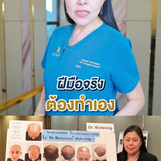 จบทุกความกังวลเรื่องปัญหาเส้นผม 
ให้ประสบการณ์และความใส่ใจดูแลคุณ 💙 

เคสยาก หรือเคสที่มีความซับซ้อ