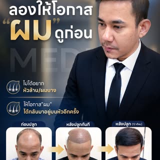 ลองให้โอกาส ”ผม” ดูก่อน…✨👨‍⚕️
เพราะความมั่นใจเริ่มต้นที่เส้นผม ให้โอกาส ”ผม” 
ได้กลับมาหนา แน่น และ
