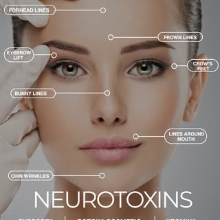 Want to soften the appearance of fine lines and wrinkles while maintaining natural-looking results? 