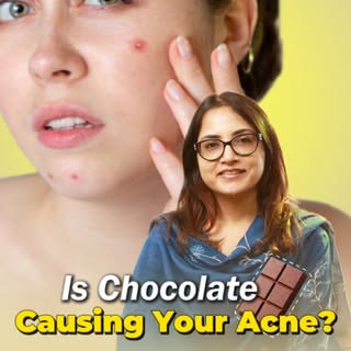 Is Chocolate Causing Your Acne?
.
.
.
.
[Acne Causing Foods, Chocolate And Acne, High Glycemic Diet,
