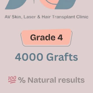 100% natural result of Hair Transplant 

📞For  more information call now: +91 63 55766 940

📍201-2