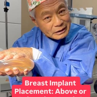 When I perform a transaxillary breast augmentation—what many call the “no-scar boob job”—the implant