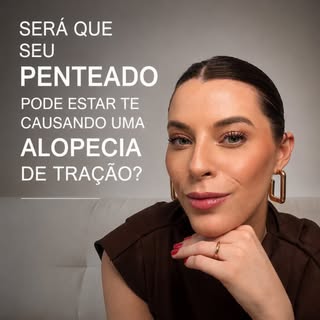 Penteados muito apertados, tranças, rabos de cavalo e mega hair podem causar alopecia de tração: uma