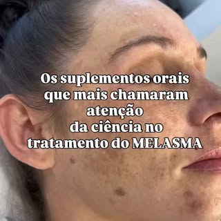 Os estudos mostram que esses suplementos podem potencializar os resultados quando associados ao trat
