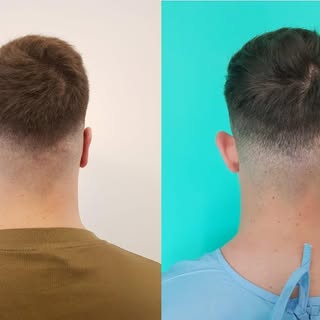 Otoplastica a Tirana, Albania: professionalità, qualità e serietà in ogni fase del percorso chirurgi