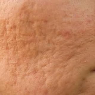 Want to keep your skin looking younger for longer? In this episode teaser, we break down the science