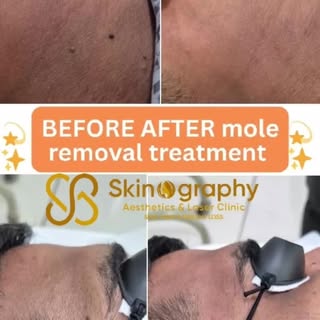 ✨️💫Real STORIES;Real RESULTS💫....with Skinography🎊🫠
POV: You finally found the solution for your