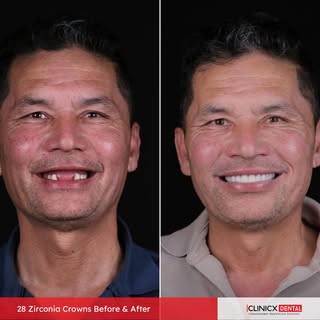 New smile in Just 5 Days , new confidence. 
 Premium dental treatments are now available at exclusiv