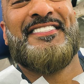 Stop hiding your smile , it’s time to let the world see the real you ⭐️ #PatientSuccessStory 🇬🇧 

