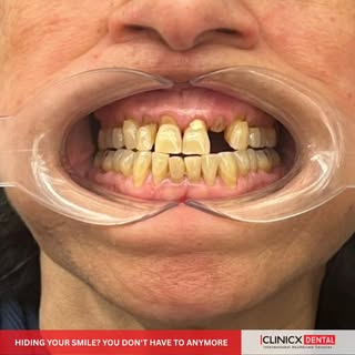 Living with missing, discolored, or misaligned teeth doesn't just affect your dental health it takes
