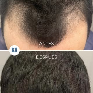☀️ El verano está a la vuelta de la esquina… y muchos pacientes aprovechan esta época para dar el pa