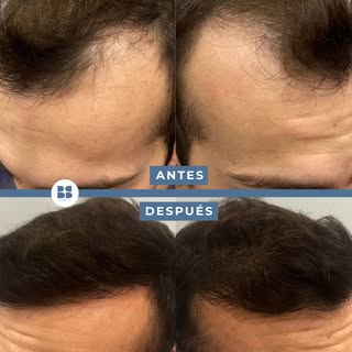 Hay cambios que hablan por sí solos. 👏

Cuando el tratamiento es el adecuado para cada paciente, la