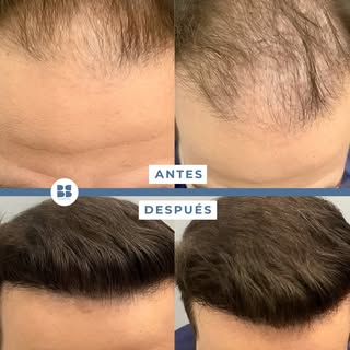 💙 Hay personas que llevan años evitando ciertas situaciones sin darse cuenta.

🧢 La gorra acaba fo