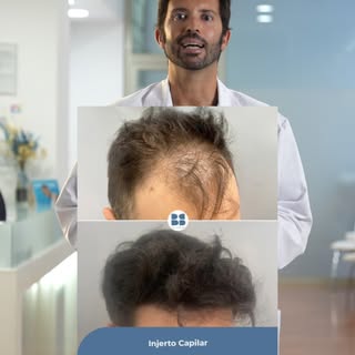 ✨ Hay decisiones que cambian mucho más que tu imagen.

Recuperar tu cabello también puede significar