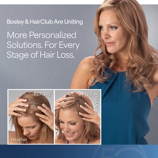 Bosley and HairClub are uniting to create North America's most comprehensive hair restoration compan