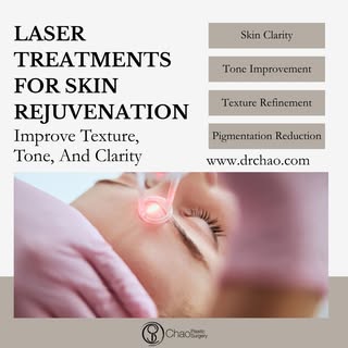 Laser treatments target a variety of skin concerns including pigmentation, sun damage, uneven tone, 