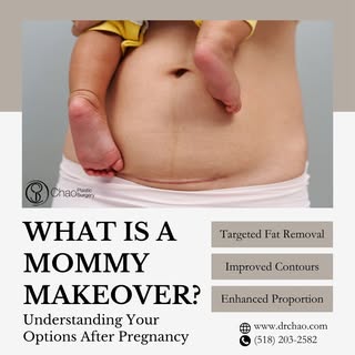 A Mommy Makeover is a customized combination of procedures designed to address changes in the breast