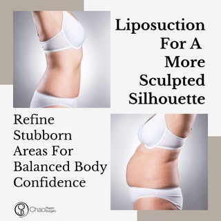 Liposuction helps remove stubborn fat deposits that do not respond to diet and exercise. It is desig