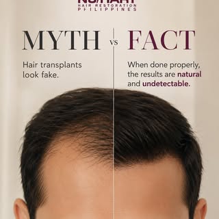 Don’t let myths stop you from restoring your confidence.

A properly performed hair transplant doesn