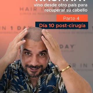 Después de 10 días, Nashaat llegó a una etapa que esperaba con emoción: ver cómo evoluciona su proce