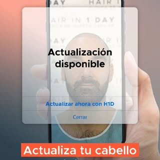 No se trata de ocultar tu calvicie ni de adaptarte, sino de recuperar lo que ya no está. 👌🏽

La me