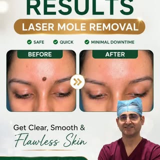 A confident smile begins with clear, healthy skin.

See the amazing Before & After results of our La