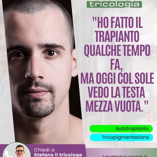 "HO FATTO IL TRAPIANTO QUALCHE TEMPO FA, MA OGGI COL SOLE VEDO LA TESTA MEZZA VUOTA."

La luce forte