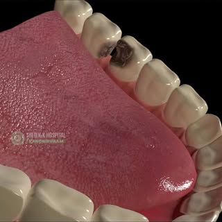 Smoking + Drinking = Gum Disease 🚬🍷  

 Gum Disease = Inflammation 🫀  

 Root Canal = Bye-Bye Inf