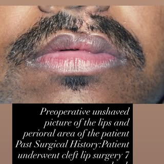 Let’s enhance confidence by filling life with colours and lips with Fillers !❤️😊🌿 At The National 