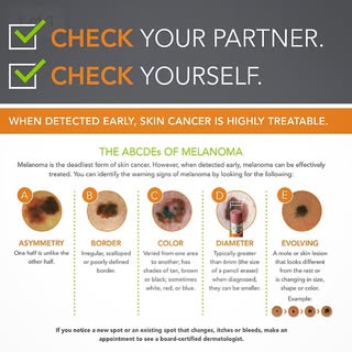 May is #SkinCancerAwarenessMonth and today is #MelanomaMonday. Melanoma is the deadliest form of ski