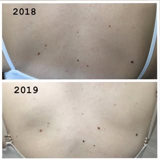 Can you spot the difference? ➡️ to see the answer.
🔹This patient example highlights the importance 