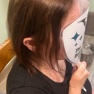 Hair Loss due to medication☹️