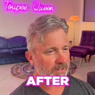 Absolutely STUNNING 😊
#toupee #bald #hair #hairsystem #sandiego
