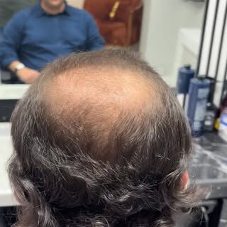 “Gerçek olan saç değil, hissettiğindir.
Sky Hair ile doğallığı yaşa.”
#ankara 
#protezsaçmerkezi 
#p