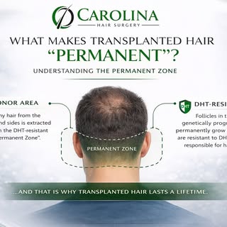 What makes transplanted hair permanent?

Hair used in transplants is taken from the back and sides o